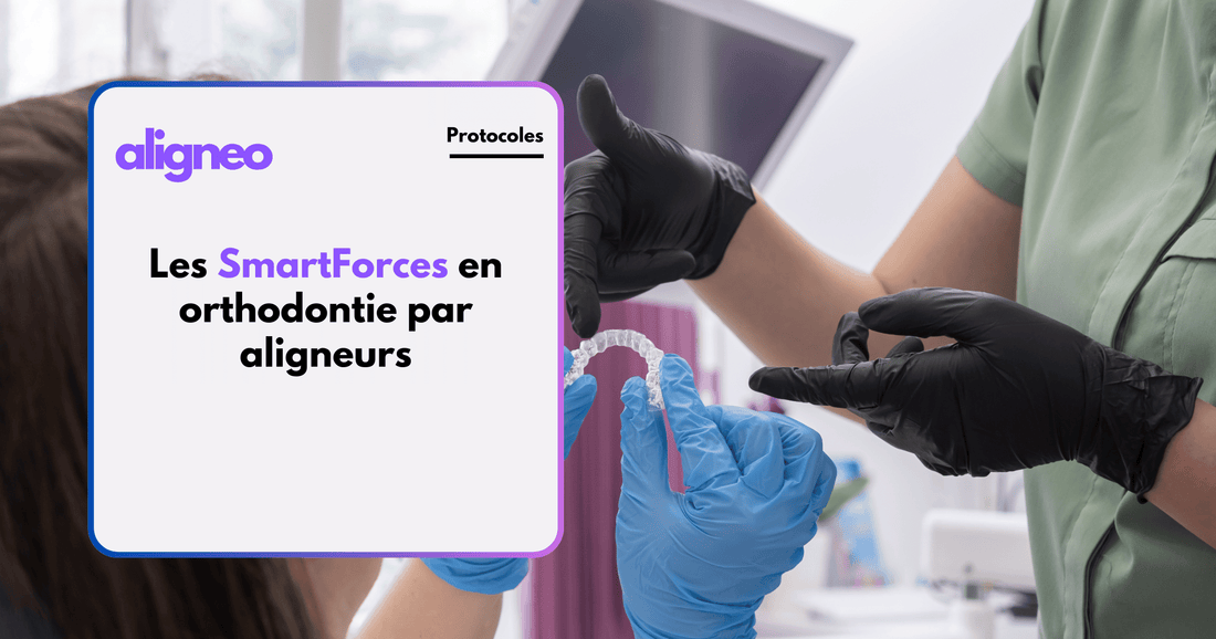 Les SmartForces en orthodontie par aligneurs